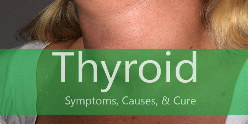 thyroid symptoms